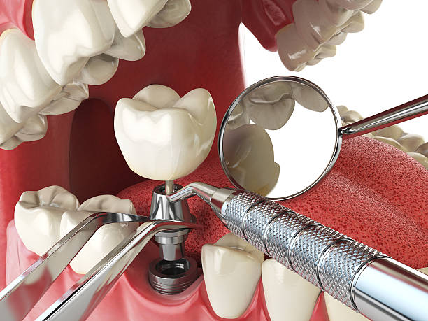 Fast & Reliable Emergency Dental Services in TN